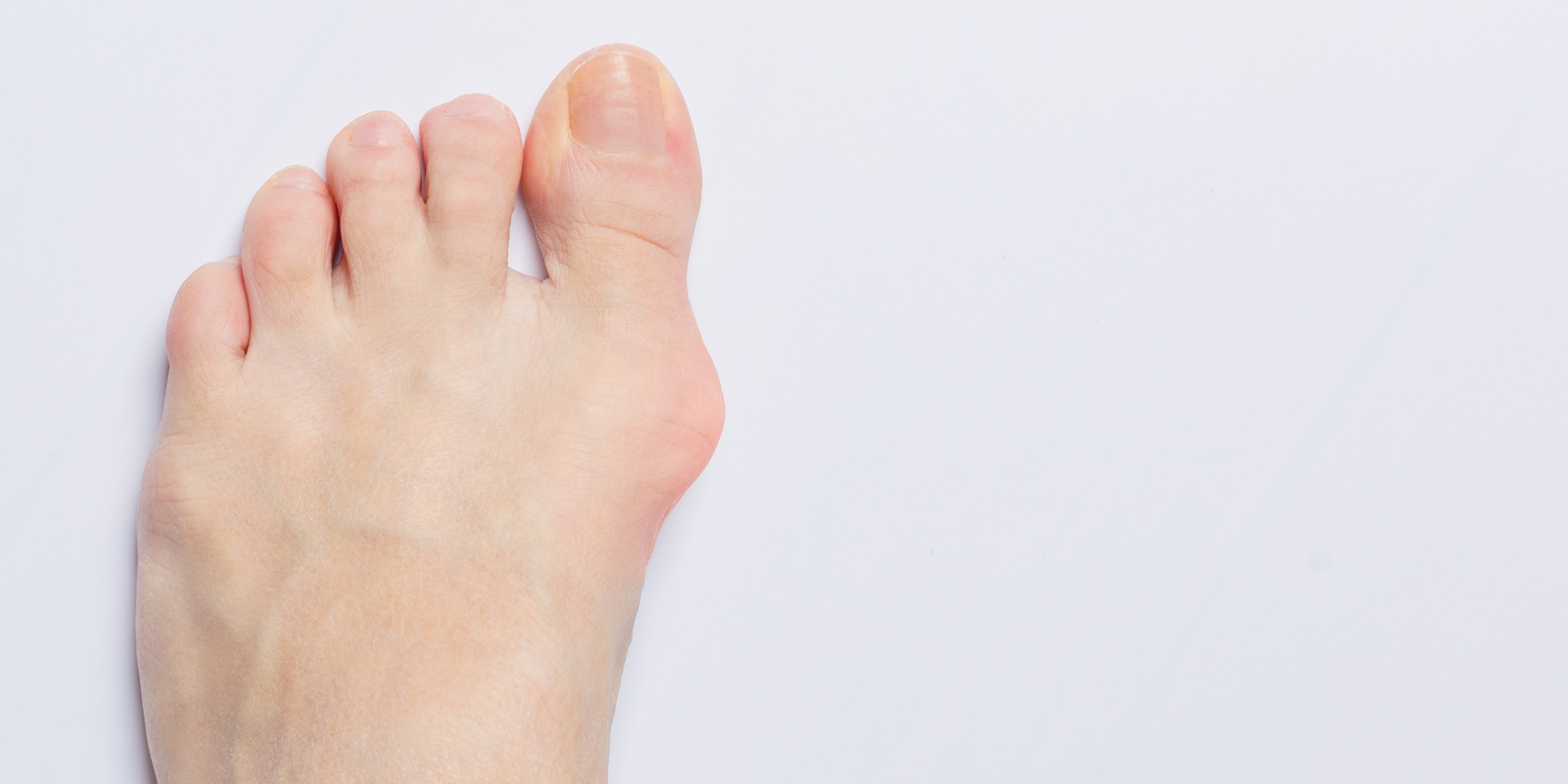 AdobeStock_329900458_feet