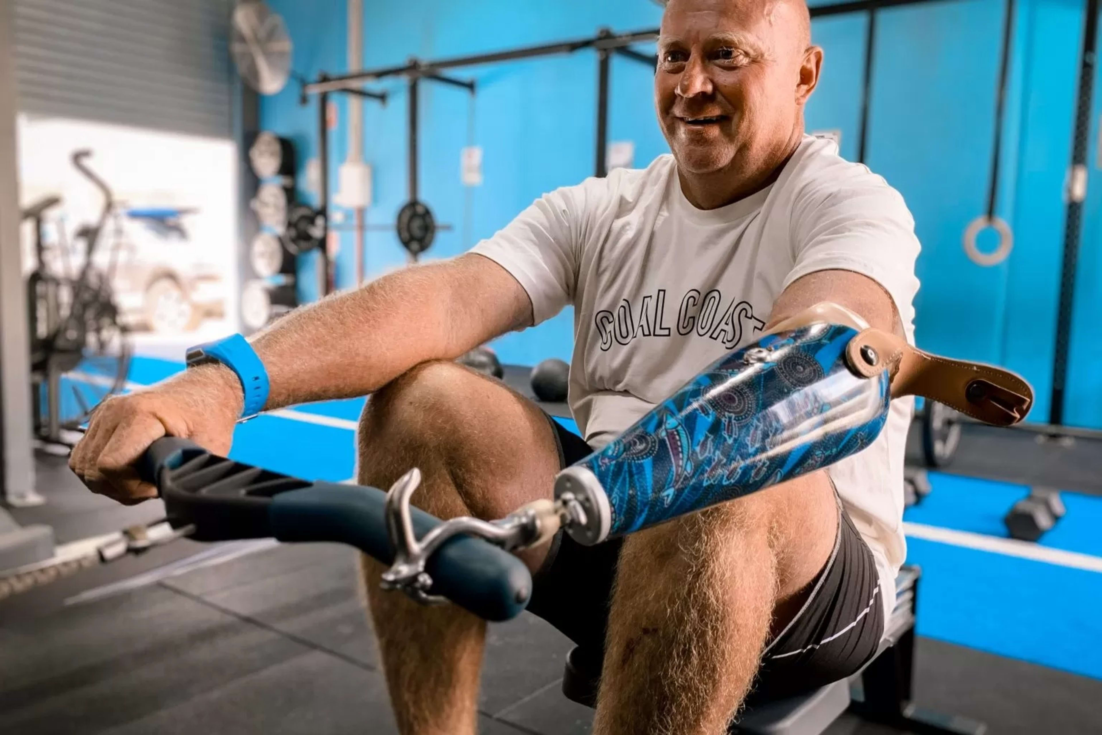 Upper-Limb-Transradial_Gym_Lifestyle-Image